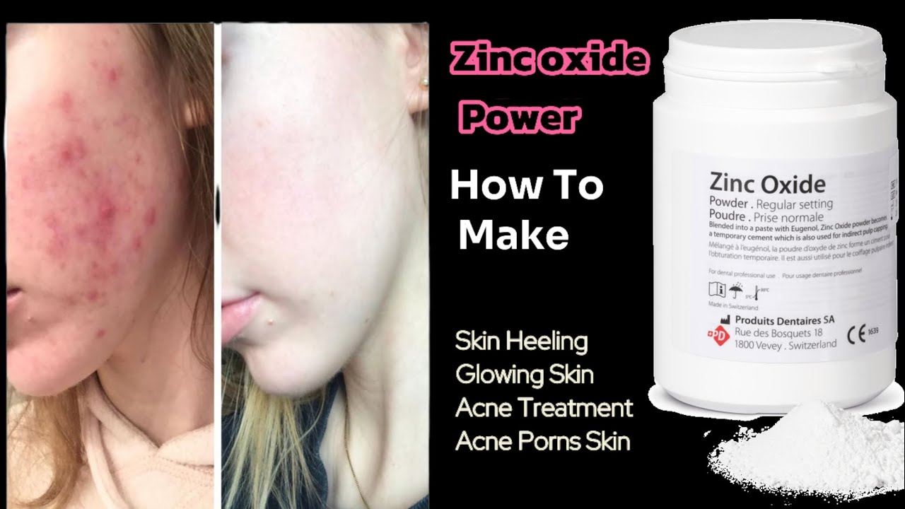 Zinc Oxide Powder For Instant Skin Glow & Tan Removed | Zinc oxide Megical 5 Remedies✨