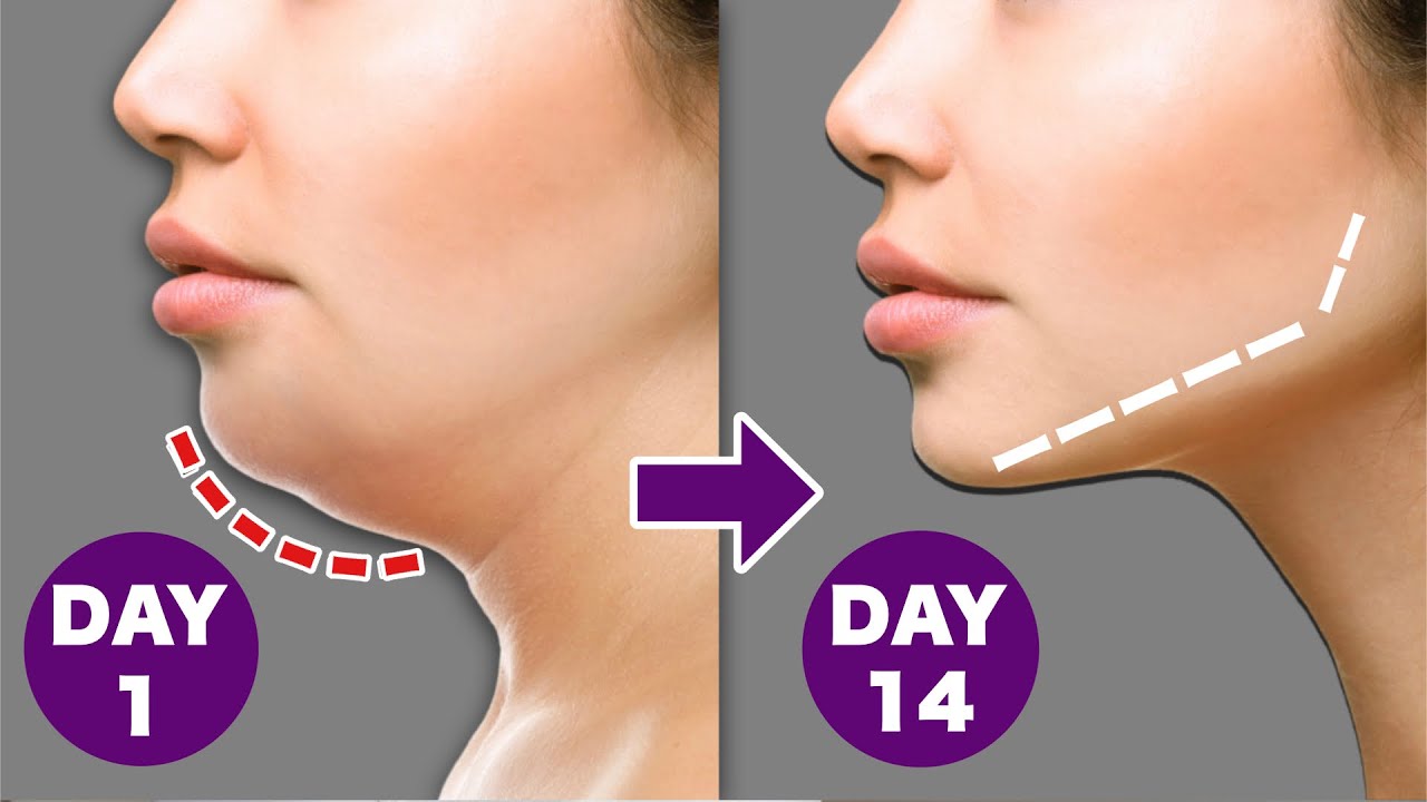 ДЕНЬ 1 ИЗ 14 | ДВОЙНОЙ ПОДБОРОДОК + ЖИР НА ЛИЦЕ + ЖИР ШЕИ | С ДЕТСКОМ ЛИЦОМ ВЫГЛЯДИТЕ МОЛОДЕЖИ