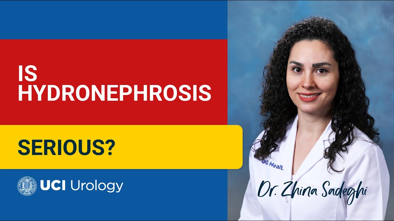 Is Hydronephrosis Serious? by Dr. Zhina Sadeghi - UC Irvine Department of Urology
