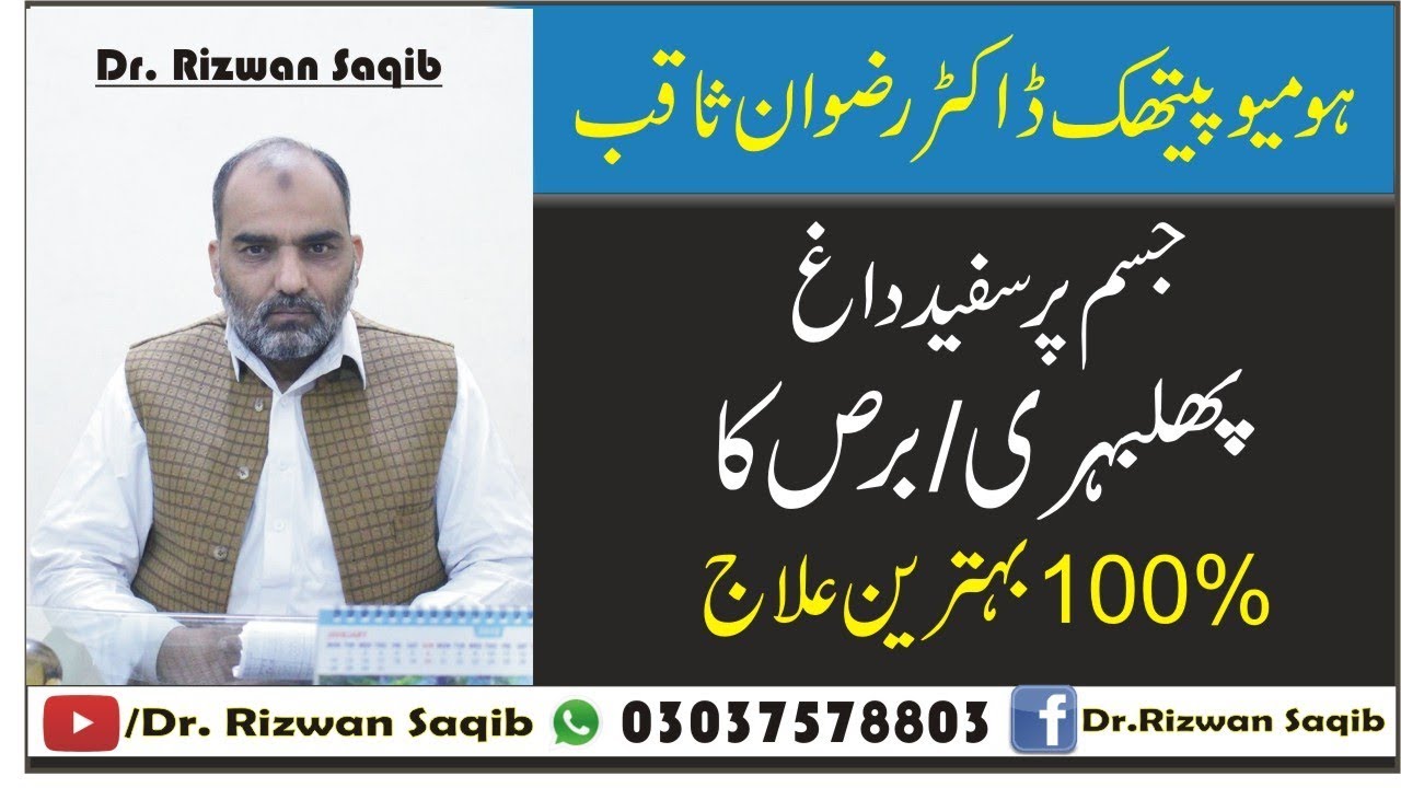 Phulbehri (Phalweri) Ka Ilaj | Leucoderma or Vitiligo Treatment | Dr. Rizwan Saqib | In Urdu/ Hindi