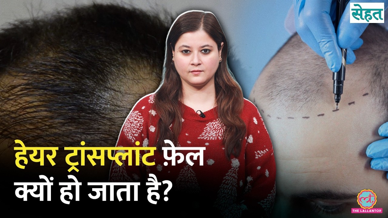 Hair Transplant के बाद भी Hair Growth नहीं? ये गलतियां हैं वजह | Hair Loss | Sehat Ep. 1311