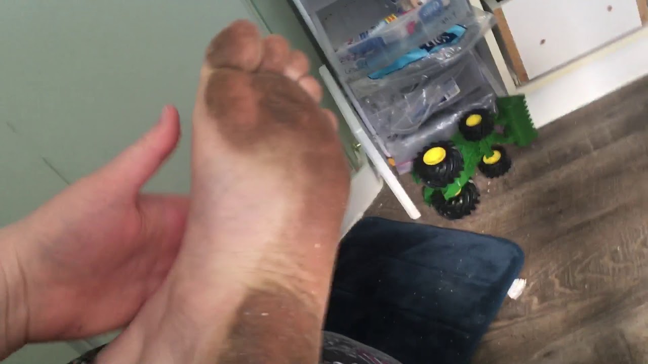 Post barefooting