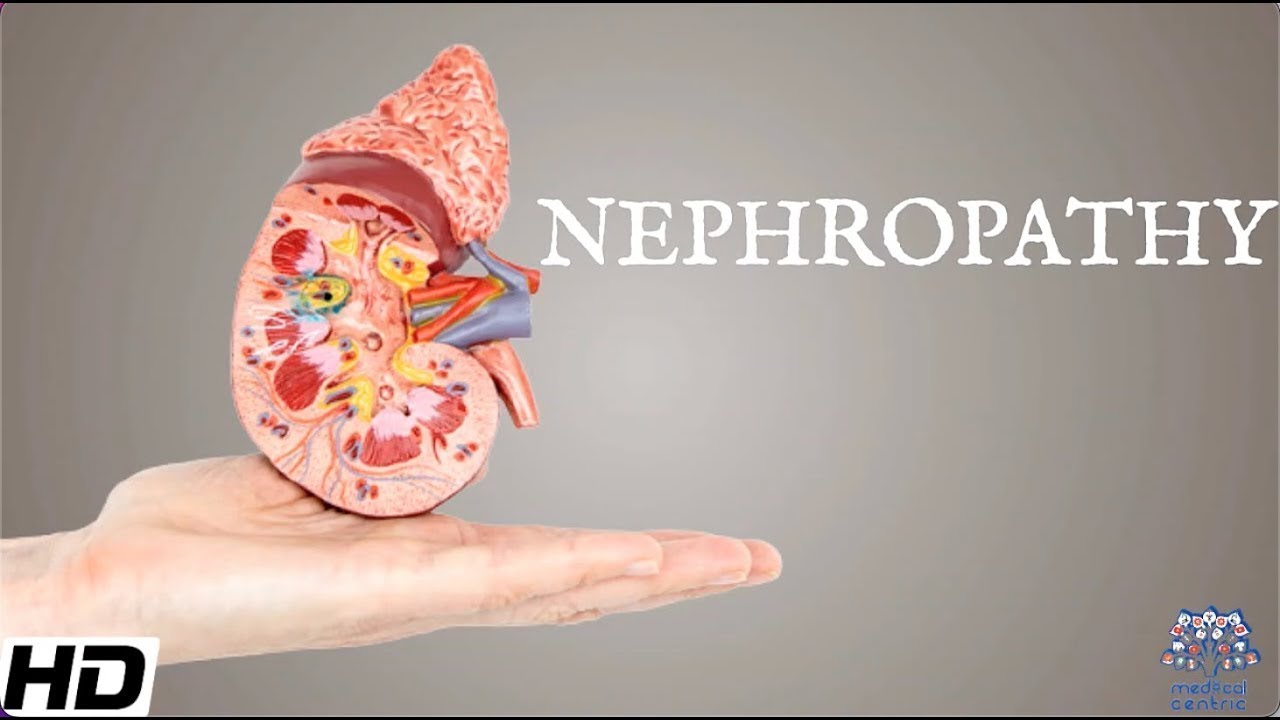 Nephropathy: Everything You Need To Know