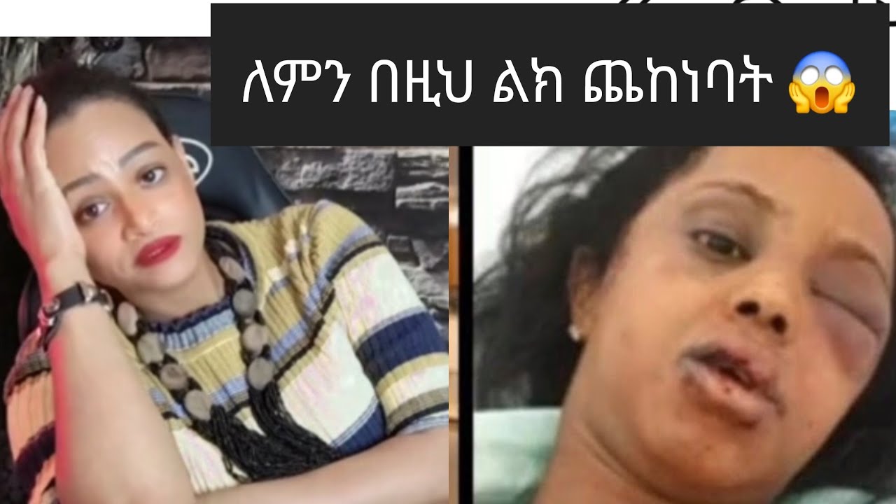 ህግ ባለበት ሀገር ሁና ለም ወደ ህግ አልሄድሽም ምክኒያት😱#ethiopia #habesha #duet 