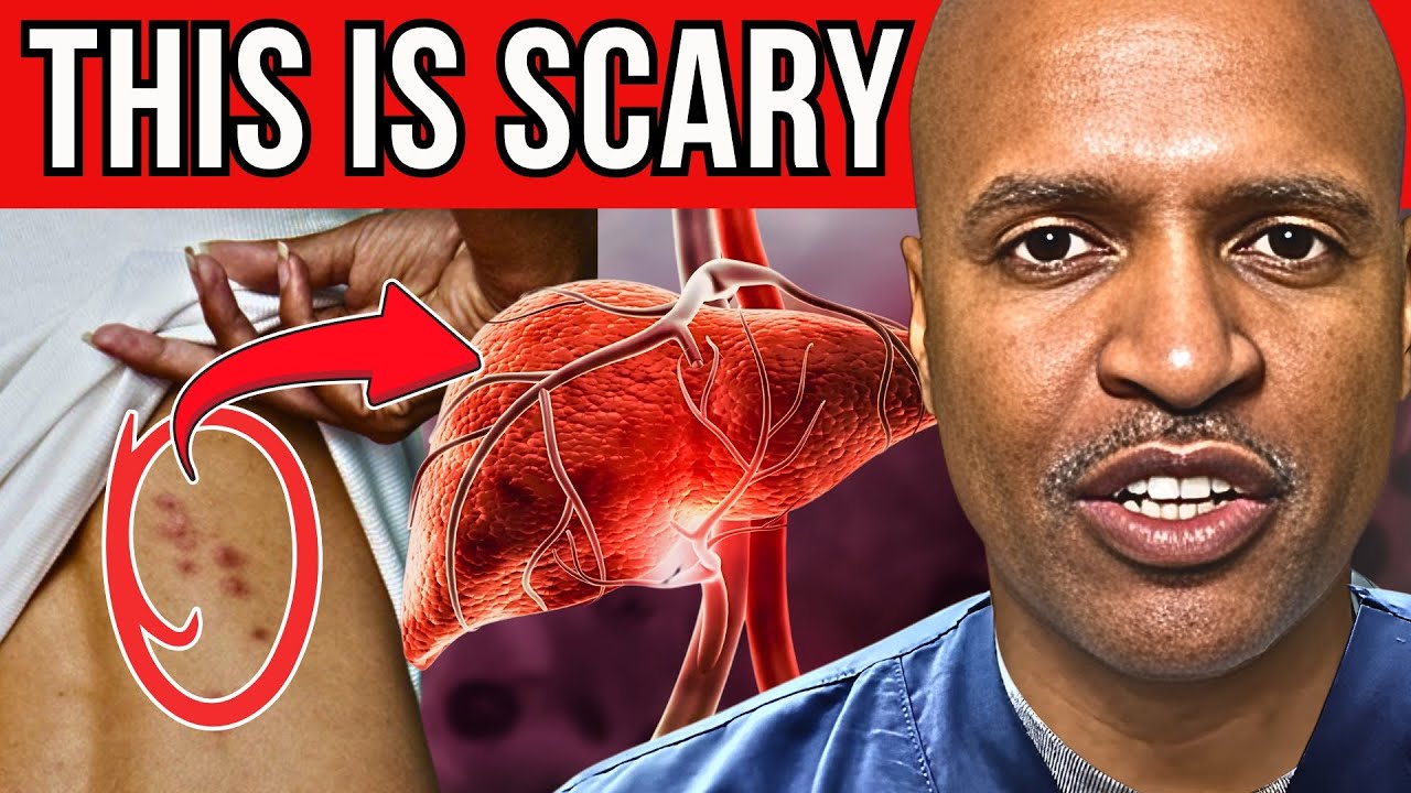 THE HIDDEN LIVER: 10 Silent Signs Blocking Your Weight Loss
