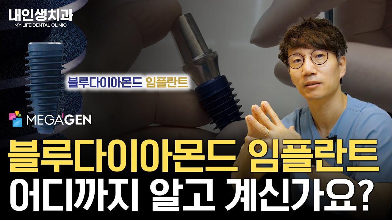 메가젠 블루다이아몬드 임플란트 어디까지 알고 계신가요?