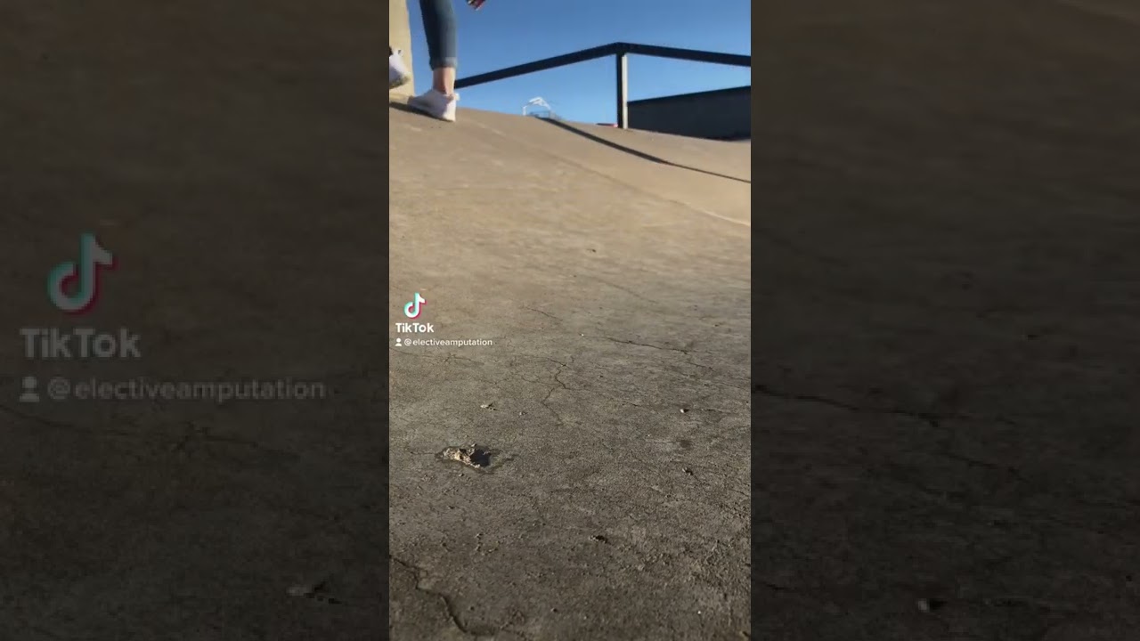 Amputee walking uphill and down hill in a prosthetic leg?
