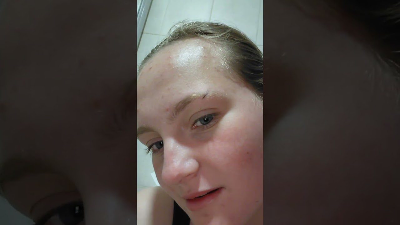 EYEBROW SLIT FAIL