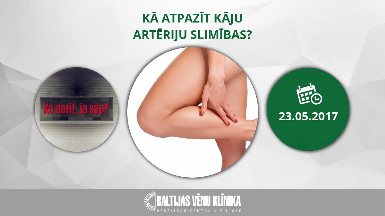 Kā atpazīt kāju artēriju slimības?