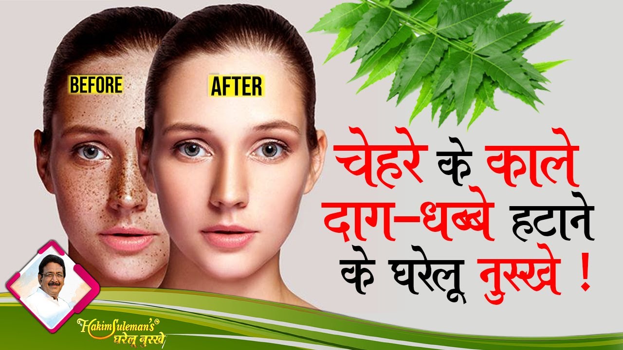 Dark Spots on Face:जानिए चेहरे के काले धब्बों से कैसे पाए छुटकारा | Hakim Suleman Khan | Desi Nuskhe
