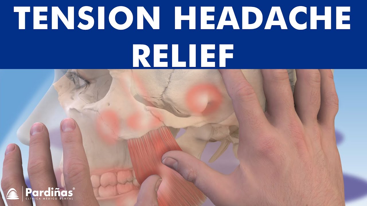 Myofascial pain syndrome treatment -  How to RELIEVE TRIGGER POINTS with physiotherapy &copy;