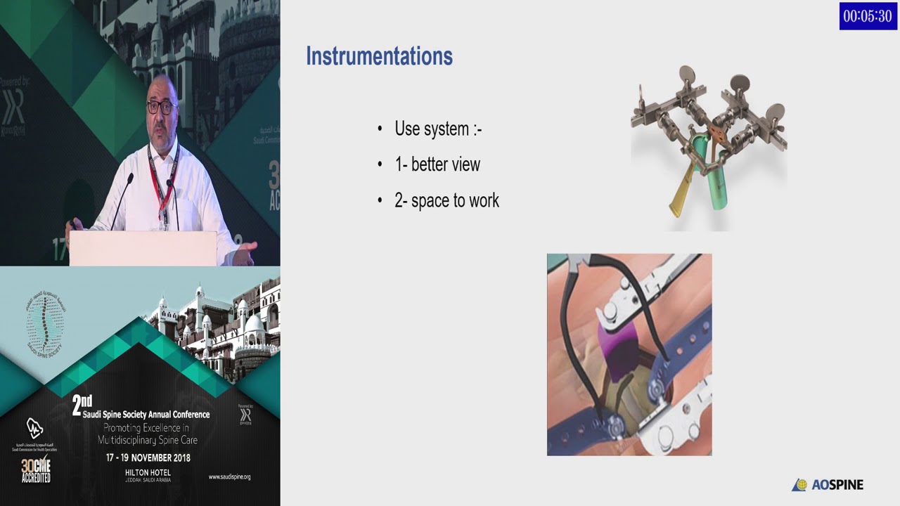 Avoidance of Complications in Minimal Invasive Spine Surgery (MIS) by Dr. Mahdi Bassi