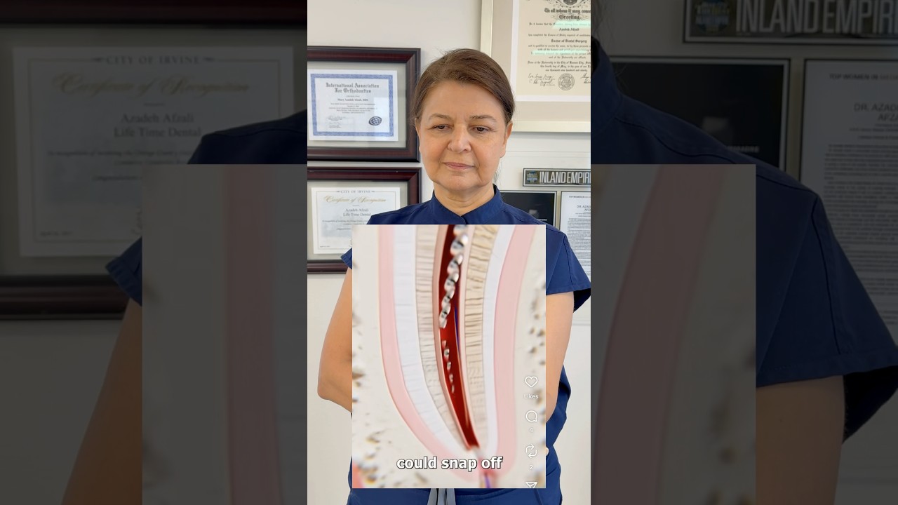 Dentist reacts to root canal procedure gone wrong&hellip;#rootcanal #rootcanalprocedure #rootcanaltreatment