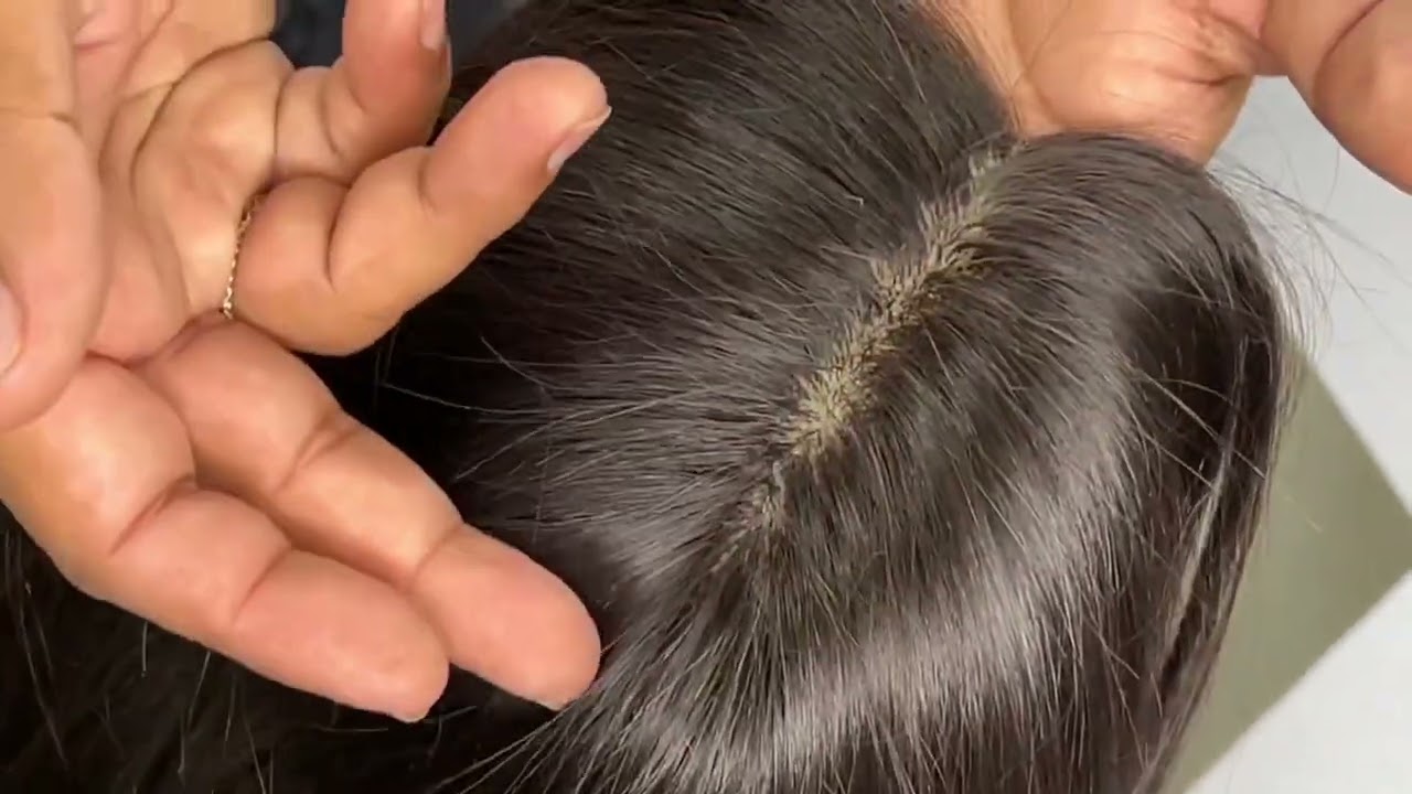 Best hair wig for Alopecia and Cancer patients…..#hairwig #hairsolution #thinkwigkanpur