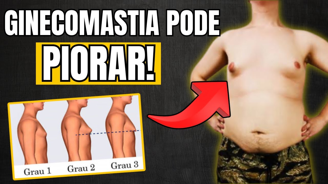 A GINECOMASTIA PODE PIORAR COM O TEMPO! #DRJORGECORTES