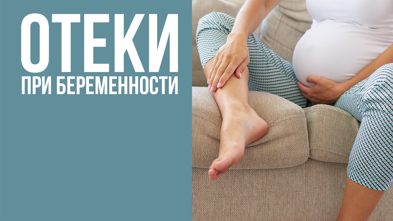 Что помогает от отеков во время беременности? Причины отечности при беременности