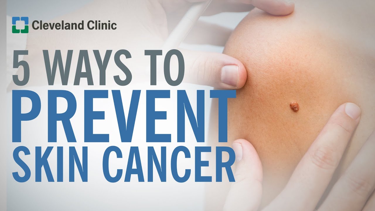5 Ways to Prevent Skin Cancer