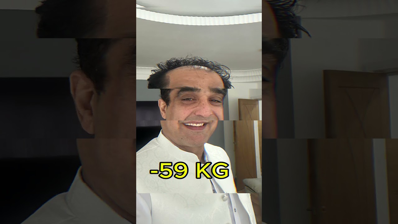 Before & After | OBESITY SURGERY in TURKEY
