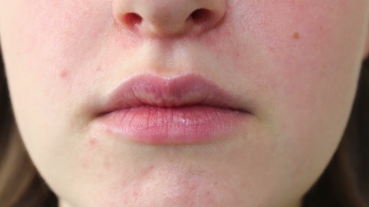 The Shocking Truth About Steroid Creams: 5 Negative Effects You Need to Know!