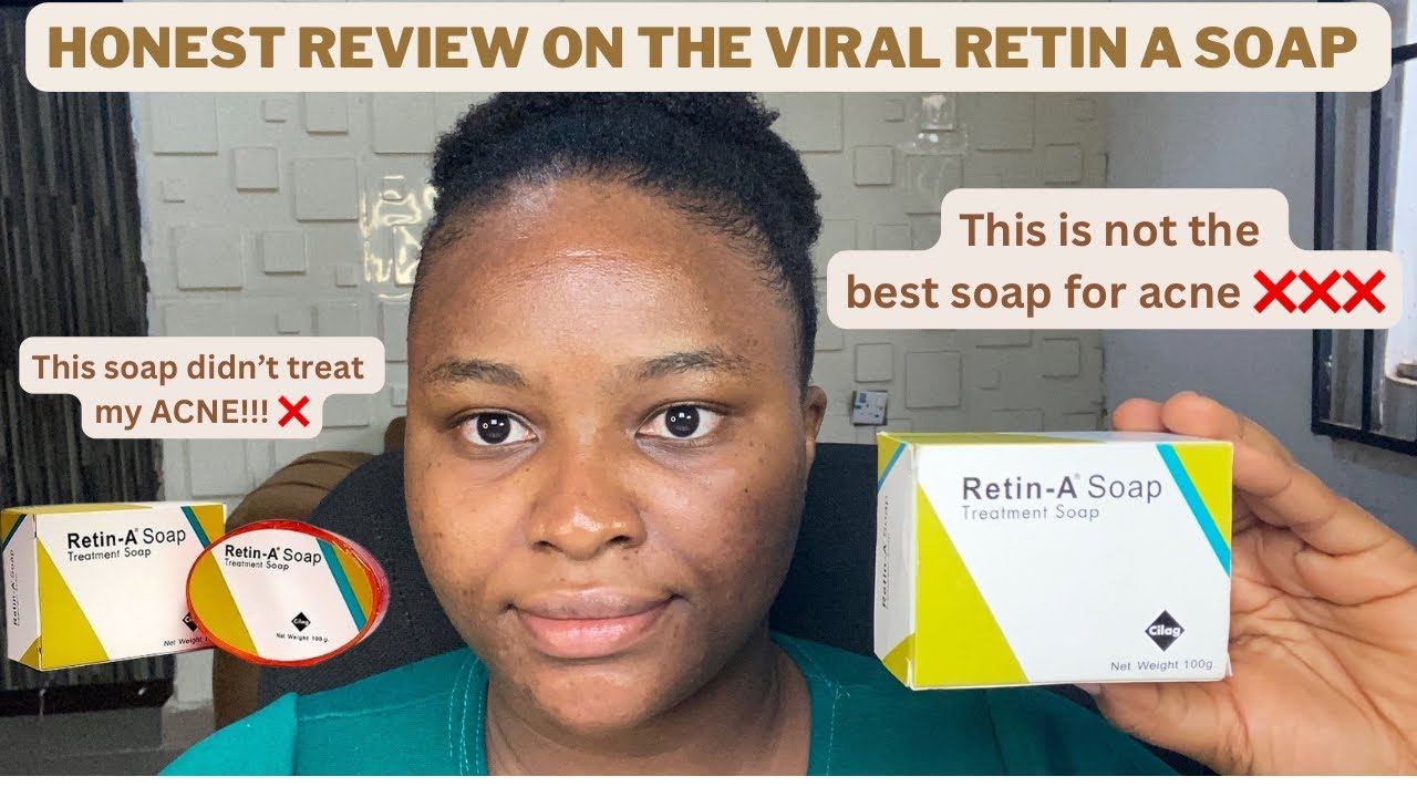DON’T BUY RETIN A SOAP BEFORE WATCHING THIS VIDEO |DON’T WASTE YOUR MONEY| TREATMENT SOAPS FOR ACNE