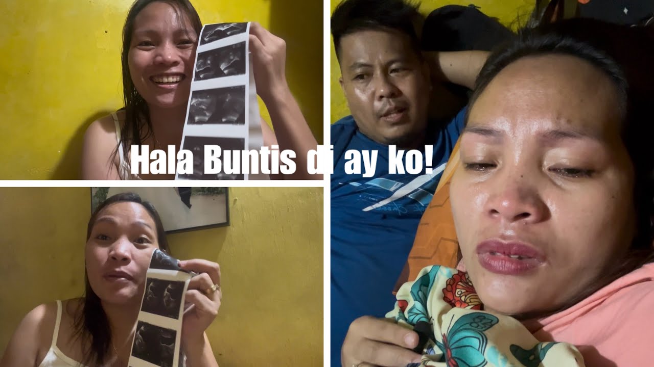 GRABE KA LOOY SAKITA SA DUGHAN/HOMAN NAKU UG PA ULTRASOUND/TerryBurst