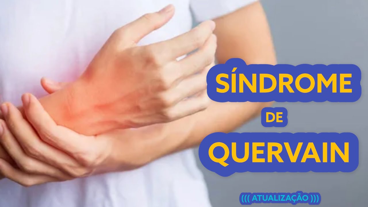 SÍNDROME DE QUERVAIN - Atualização com exercícios. #fisioterapia #aliviodador