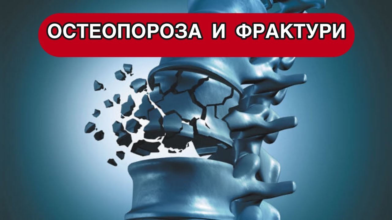 Остеопороза и фрактури в напреднала и старческа възраст. Костно здраве. Проф. Михаил Боянов