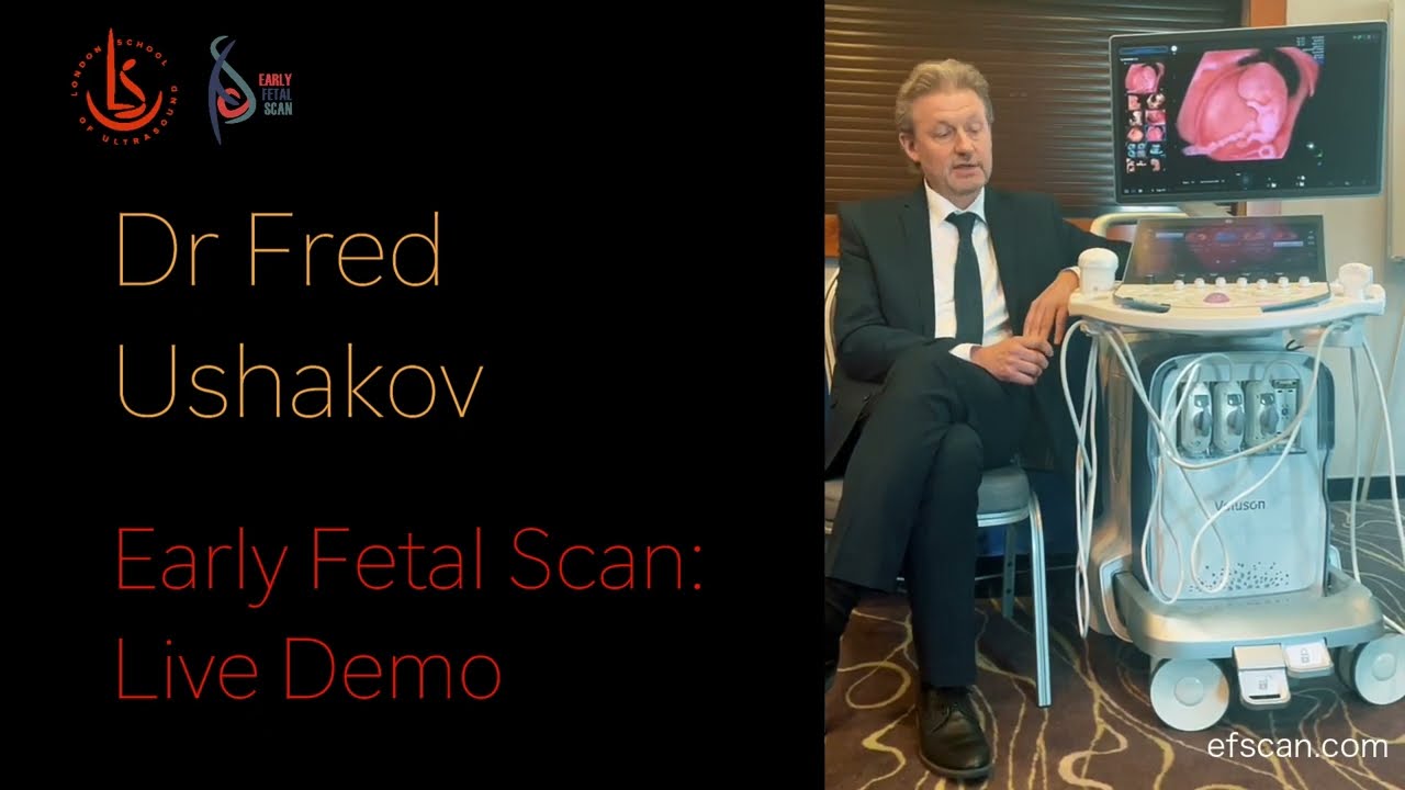 Dr Fred Ushakov - Early Fetal Scan Live DEMO - VOLUSON Expert 22