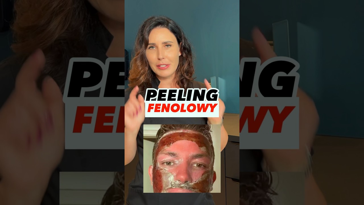 Peeling fenolowy❗️Hit czy kit❓ #peelingfenolowy #marosz #agnieszkamarosz #lifting #fenol #peeling