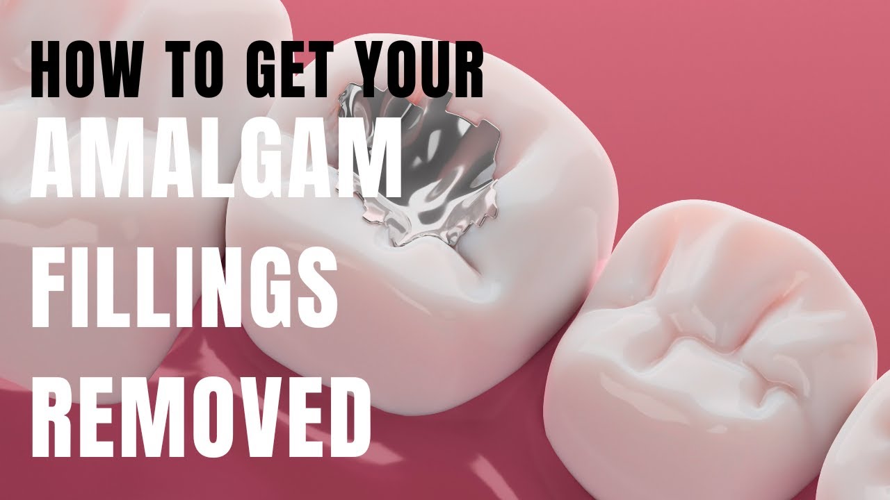 How To Get Your Amalgam Fillings Removed [Holistic Dentist Brisbane]