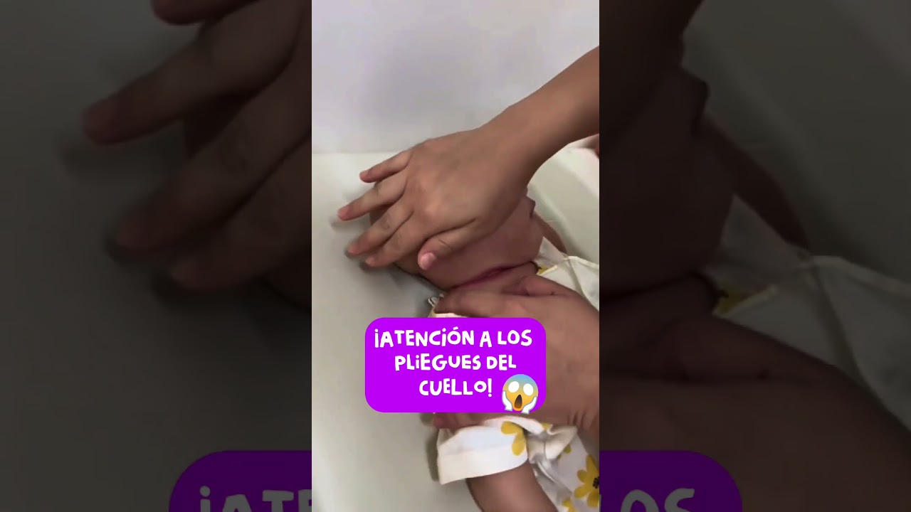 ⚠️&iexcl;Atenci&oacute;n a los pliegues del cuello! #feed #viralshorts #pediatria #ni&ntilde;os #bebe