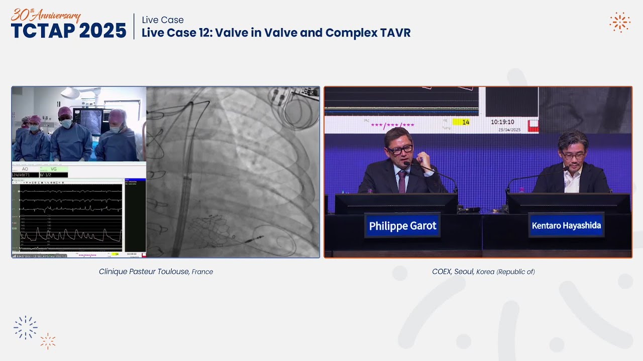 [TCTAP 2025] Live Case 12: Valve in Valve and Complex TAVR