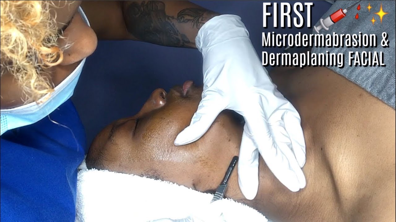 MY 1ST Microdermabrasion & Dermaplaning Facial Skin Treatment | Dark Scars & Hyperpigmentation VLOG
