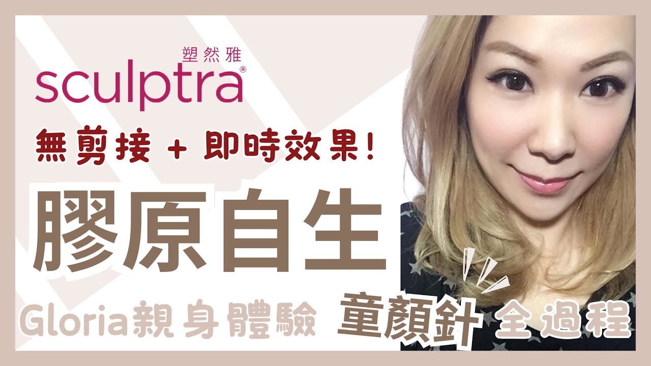 【V Beauty】Sculptra 童顏針聚左乳酸｜激活膠原自生｜Beauty Blogger Gloria 無剪接 + 即時真實分享｜醫美新手入門版