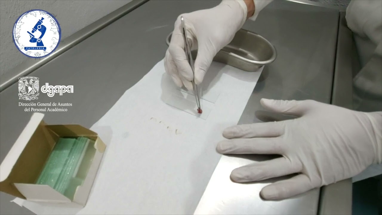 PRÁCTICA 20. TOMA DE MUESTRA CITOLÓGICA (IMPRONTA)