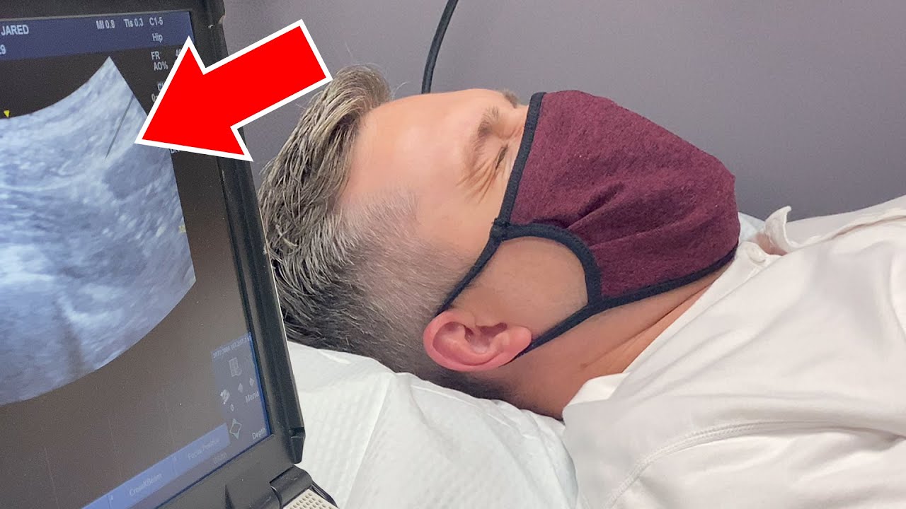 Jared's HIP PROCEDURE! 😩 Painful - Worth It? | Ellie and Jared