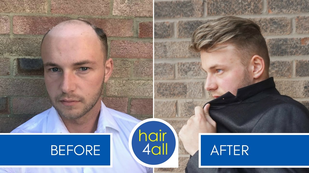 How to Apply (Attach) a Non-Surgical Hair Replacement System for Men with The Harris Brothers uk