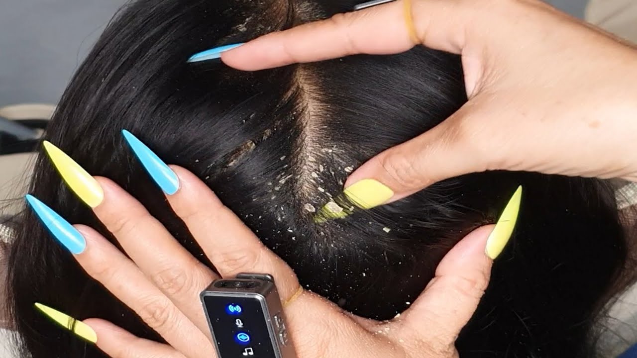 Deep Scalp Tingle Reset ASMR 🌙 | Slow Scratching, Flake Lift & Sleep Calm 