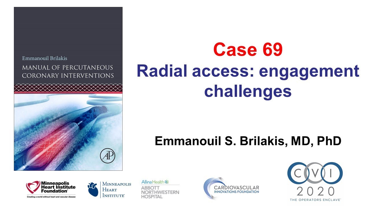 Case 69: PCI Manual - Arteria lusoria