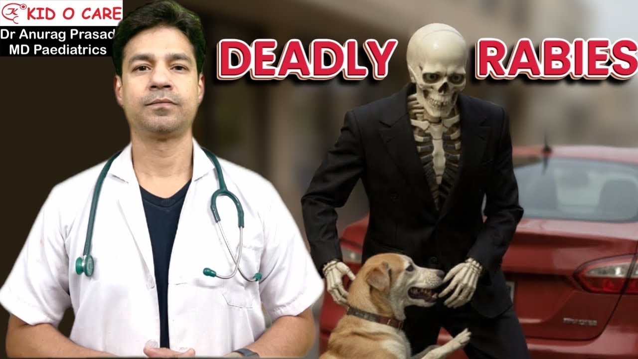 Rabies से बचने का सटीक उपाय (Rabies Prevention) by Dr Anurag Prasad
