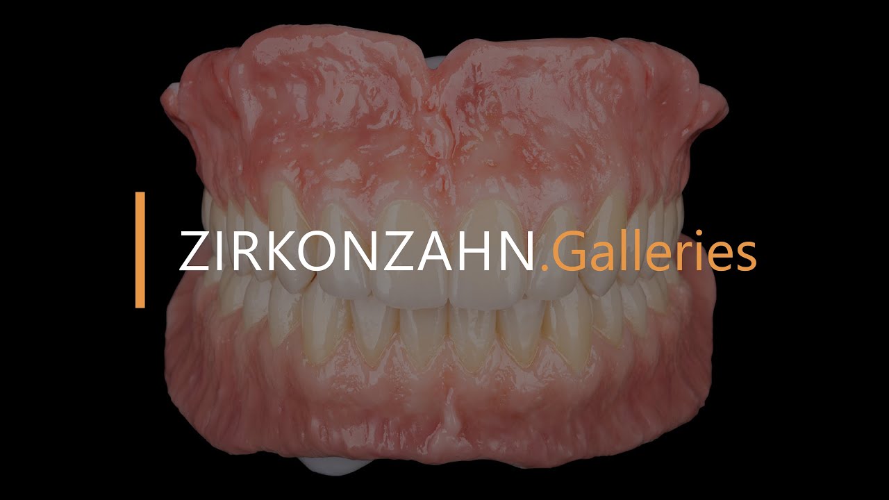 Florence Zircoprox Denture System – All made in zirconia | Zirkonzahn.Galleries