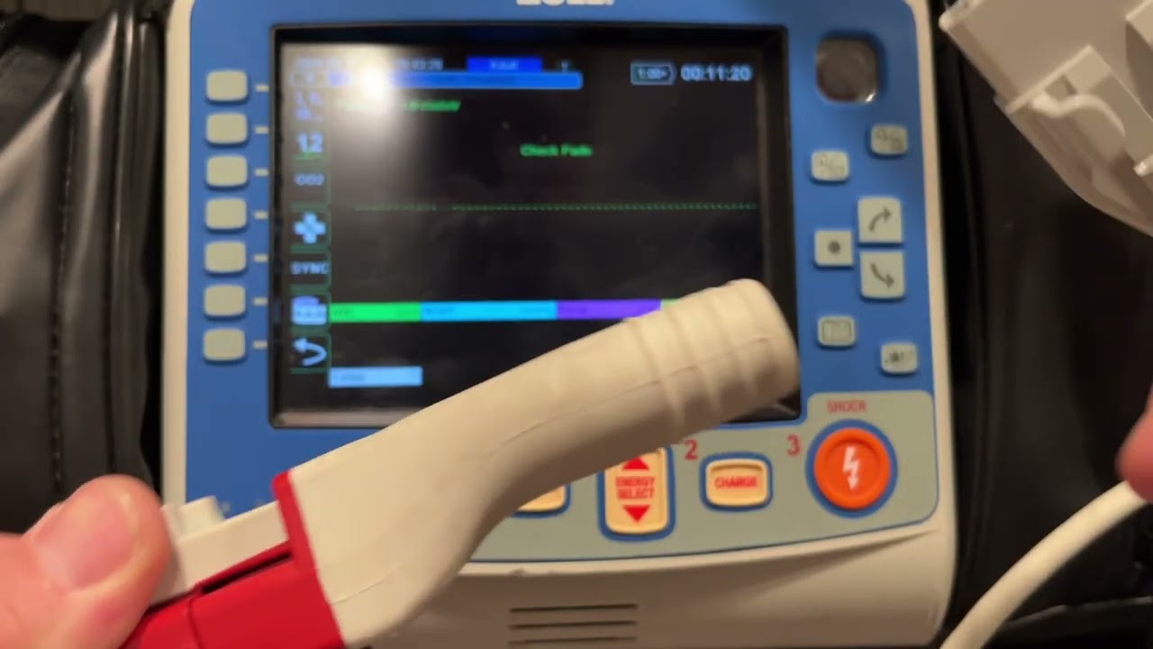 Defibrillation Pad Type and Connections-ZOLL X Series Tips and Tricks