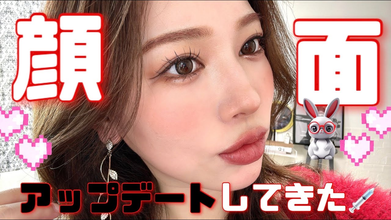 【ダウンタイム中💉】ヒアルロン酸注射の痛みは?😿