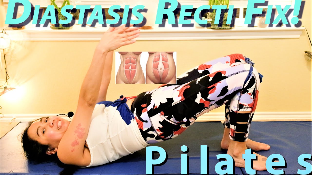 Diastasis Recti 5 Exercises To Close The Gap For Postpartum