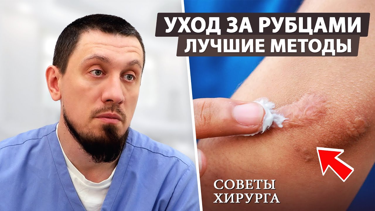 Как избавиться от рубцов после операции?