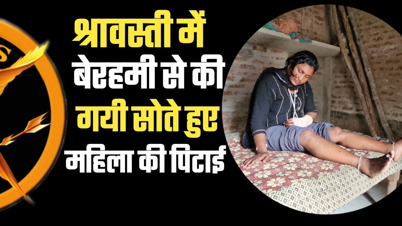 बच्चों के साथ सो रही महिला पर दबंगों ने बरसाई लाठियां,इंसाफ मांग रही महिला