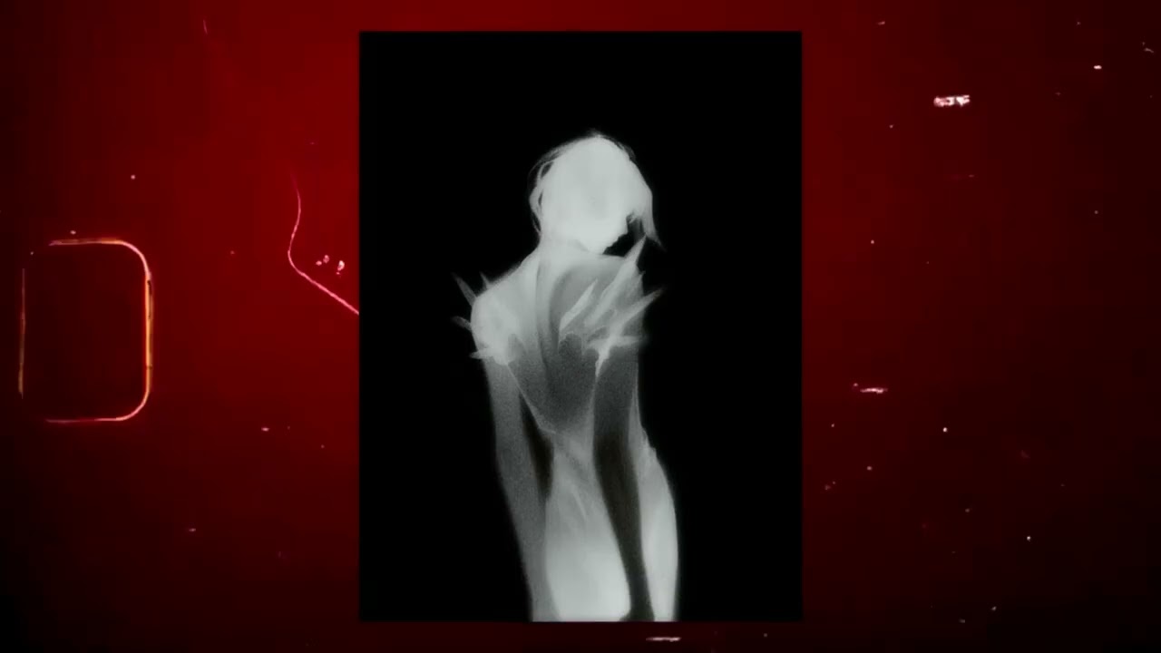 [FREE FOR PROFIT] Dark Trap Type Beat 