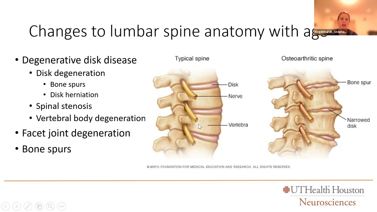 Back Pain and Aging with Dr. Stephanie Regenhardt