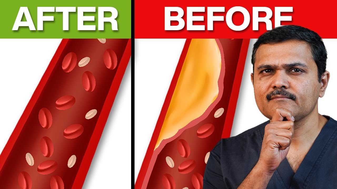 7 Foods that MIGHT Unclog Your Blocked Arteries