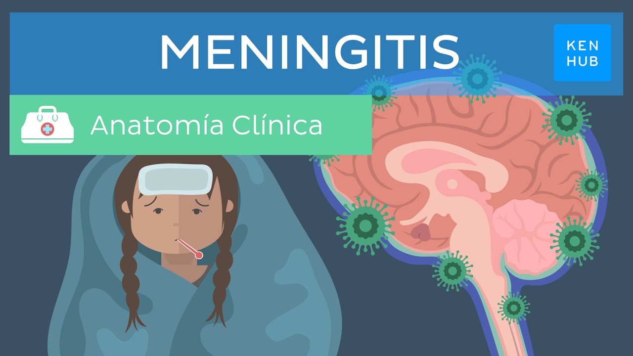 Meningitis: Definición, tipos, diagnóstico, tratamiento, prevención | Kenhub